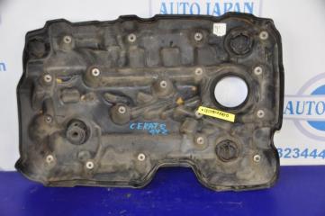Накладка двигателя декоративная CERATO LD 04-08