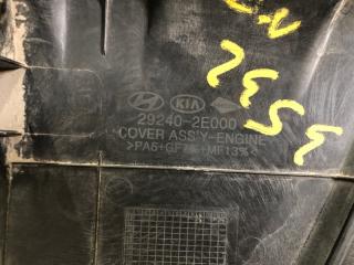 Накладка двигателя декоративная ELANTRA MD 10-15 2011 Седан 1.8L DOHC MPFI D-CVVT