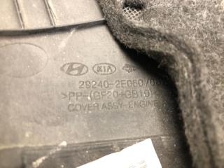 Накладка двигателя декоративная FORTE BD 18-21 2019 2.0