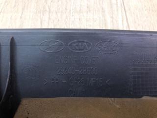 Накладка двигателя декоративная ACCENT RB 10- 1.6